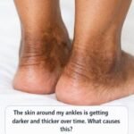 If You Often Get Leg Cramps At Night, Your Body May Be Trying To Warn You About Something